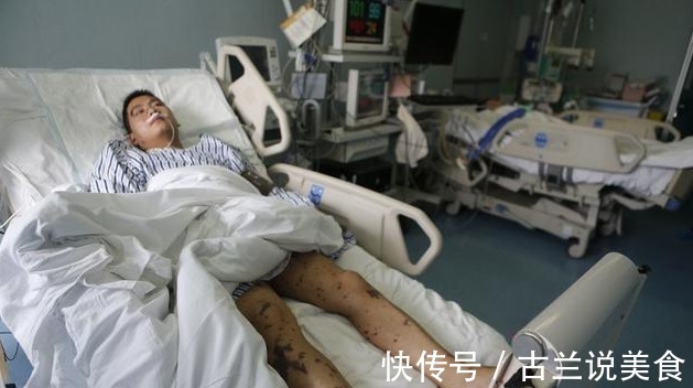 肾脏|29岁小伙,查出肾衰竭,女朋友改嫁他人,悔哭不该乱吃东西