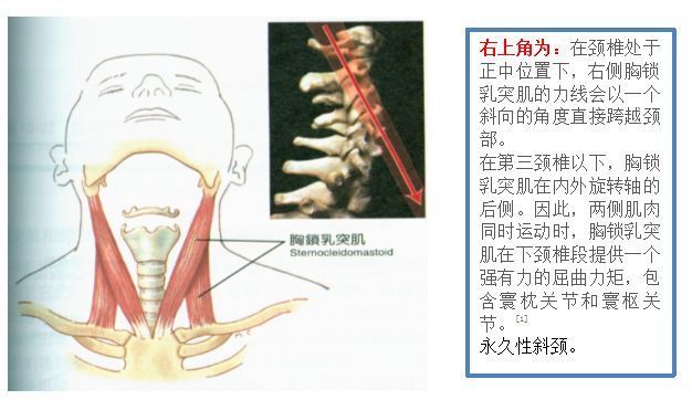 胸锁乳突肌损伤 从解剖 表现到激痛点检查及拉伸 快资讯