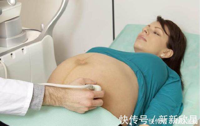 超重|胎儿是这个体重,你有福了,顺产时不受罪
