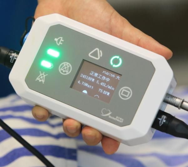 江苏省人民医院|江苏首位植入人工心脏的患者康复出院