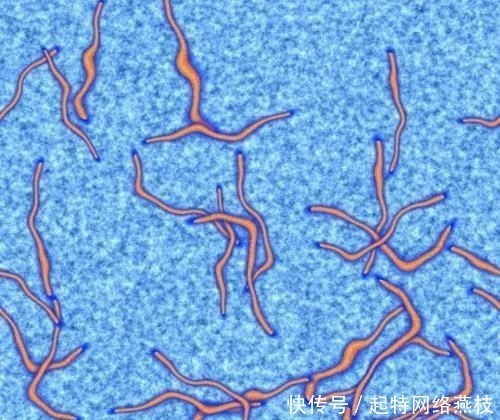 食物|8岁男孩肝脏长满虫子!医生:不要给孩子买这些食物,寄生虫太多