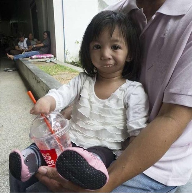 桑托斯|女孩一出生就没有手脚,没有嘴,3岁才开口吃到第一口饭