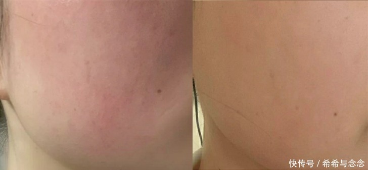 盘点|孕期护肤水乳重要还是精华重要?盘点成分党才会选的安全孕妇水乳