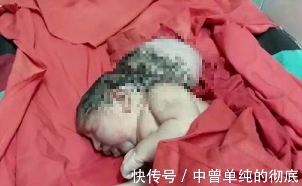 手术切除|奇闻：印度女子产下三头婴儿！怀孕期间并无异常，医生：外星人