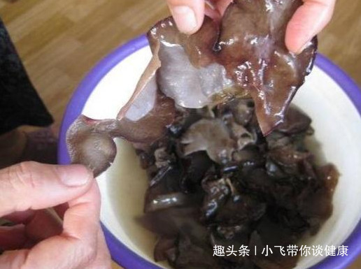 黑色食物|它是天然“阿司匹林”!早晚吃两口,血管干净,血栓悄悄“溜走”