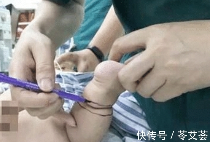 孩子|五个月男婴体重三十斤,家人带孩子常规体检,却要面临截肢的危险