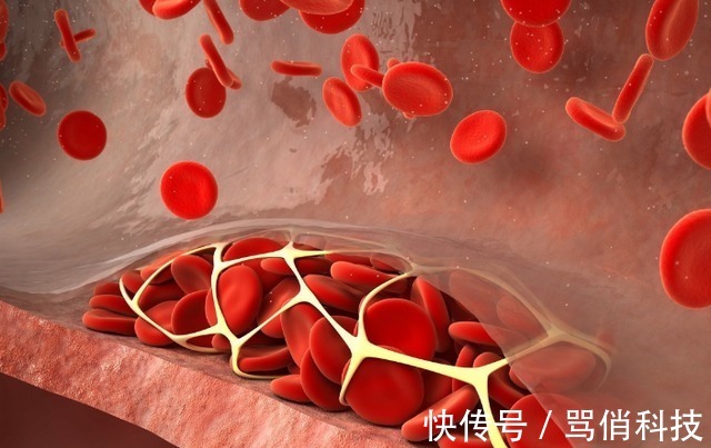 肘部|每天做俯卧撑好吗?经常做俯卧撑,4件好事自动上门