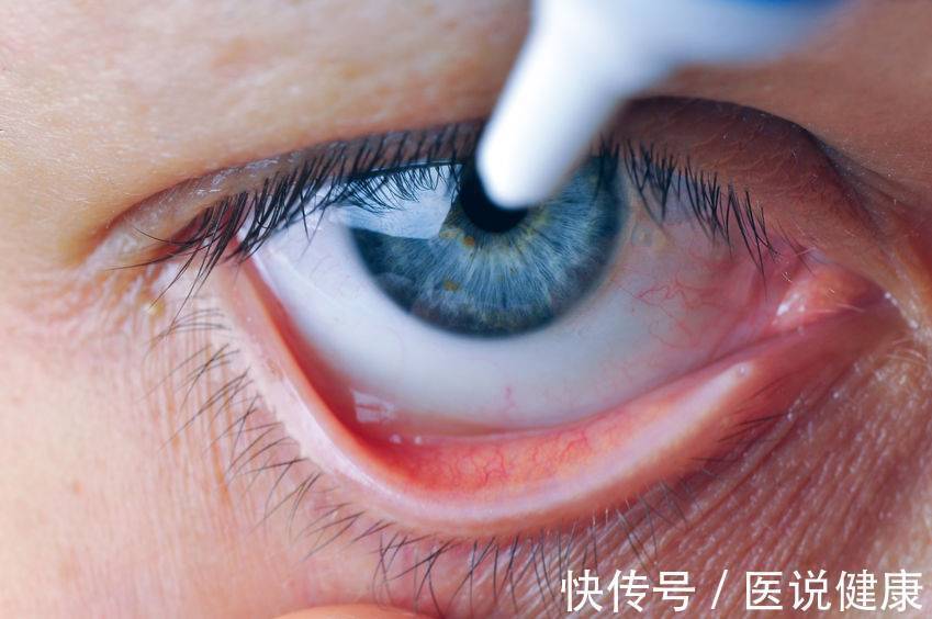 患者|视力突然下降,或与这3种疾病有关,要及时检查,找出病因