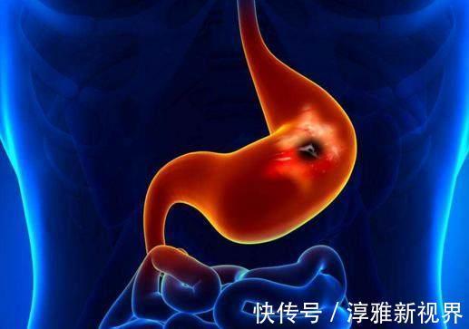肠胃疾病|养胃求人不如求己,不管男人还是女人,都尽快改掉5个伤胃坏习惯