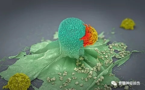 危害性|脊髓肿瘤会导致出现什么症状?