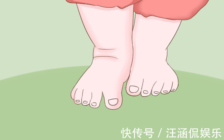 维生素d|宝宝的这几种异常走路姿势可能影响健康,快看你家宝宝有没