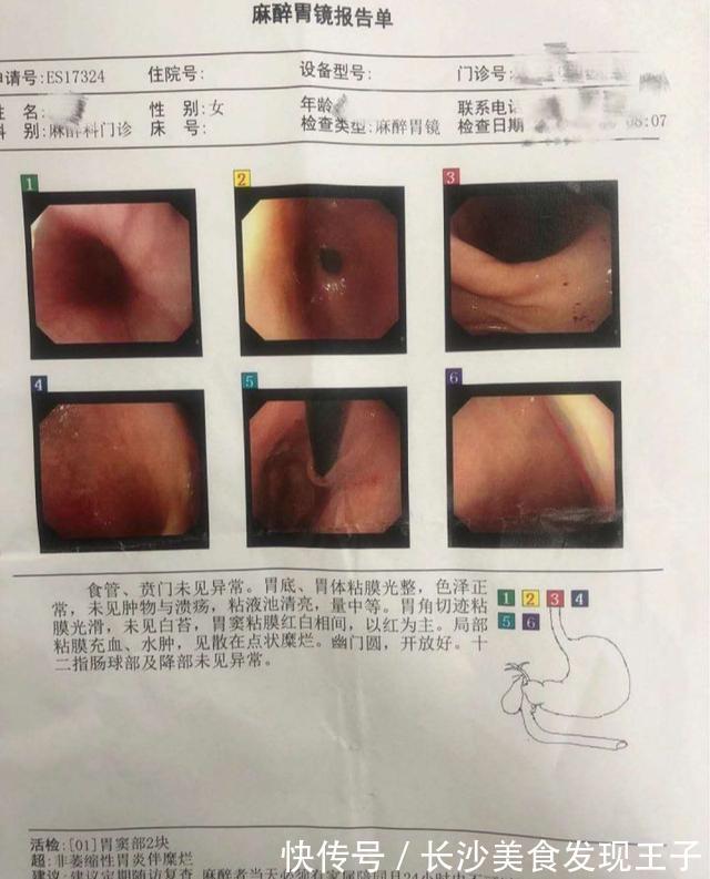 节食减肥|我花了两个月调养胃胀和胃酸，折磨了八年胃病，一个月就恢复了