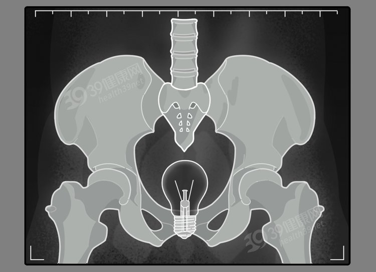 med|保护肛门有多重要？每天清洗肛门可以预防疾病？到底怎么回事？