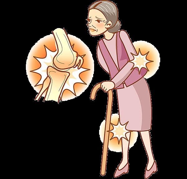 骨关节炎|这种疾病年轻人千万别轻视!