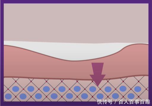 水杨酸|那些脸上没瑕疵的人,都在“酸”些什么