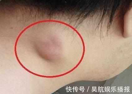 白血病|身体如果出现3种现象，说明癌症可能找上你了，尽早检查