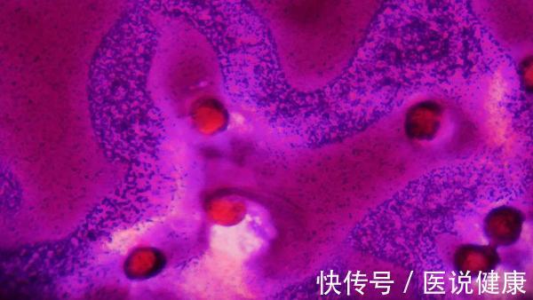 出血|血液病发病前,身体或出现这5个异常表现,发现后,需及时就医