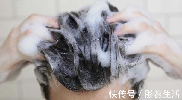刘医师|女生头发一天不洗就“油腻”,也许是4件事做得太多,记得避免下