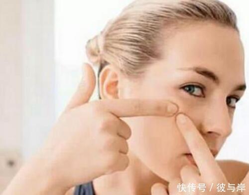 四个关于祛痘印的谣言，很伤皮肤！一定不要再用了