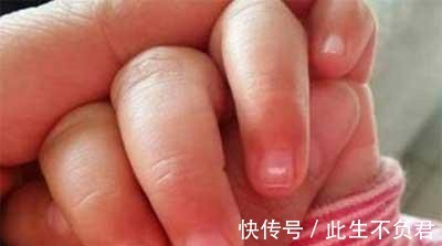 癥狀|孩子出現這5個癥狀, 就是肚子里長“蛔蟲”了！