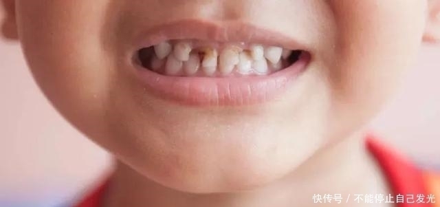 吃奶|“脚扶奶瓶”的喝奶宝宝火了,开发奇葩吃奶姿势,网友骨骼清奇