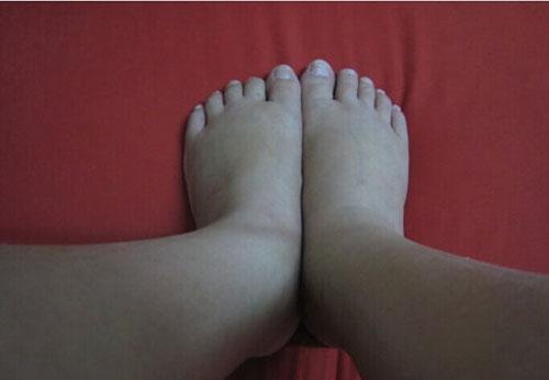 症状|8种怀孕后常见症状及缓解方法，准妈妈早知道少受罪！