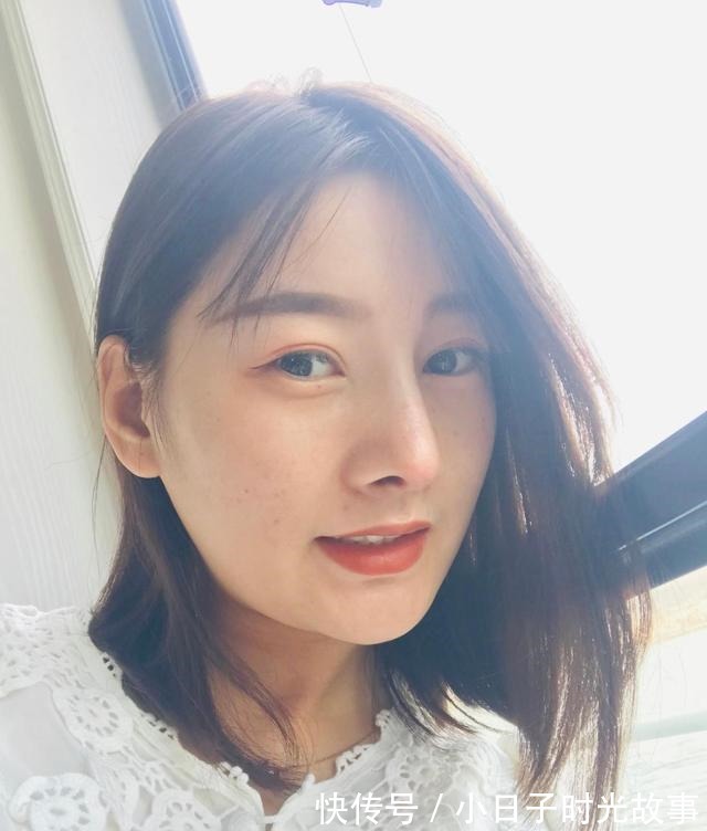 隆鼻 隆鼻手术90天,对于效果越来越满意!隆鼻手术90天,对于效果越来越满意!