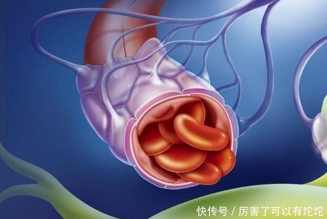 血脂|52岁王先生半年甘油三酯从5.1降到1.7,医生:或因坚持做了3件事