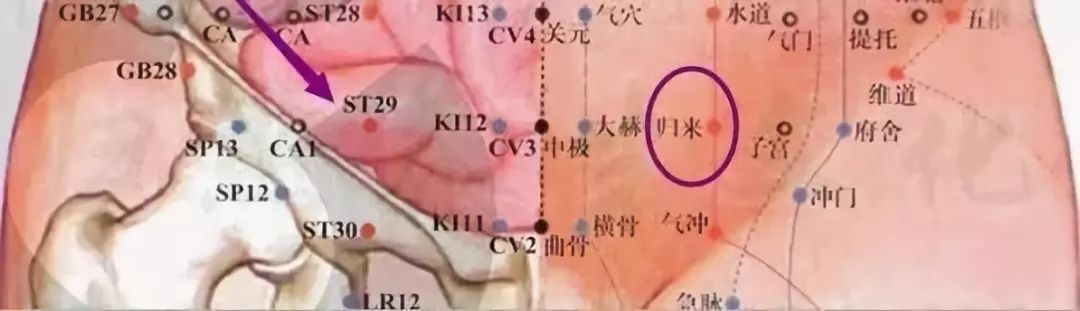 艾灸|大家好!我叫“息肉”,癌症的近亲!我最怕无情又温柔的手术刀艾灸