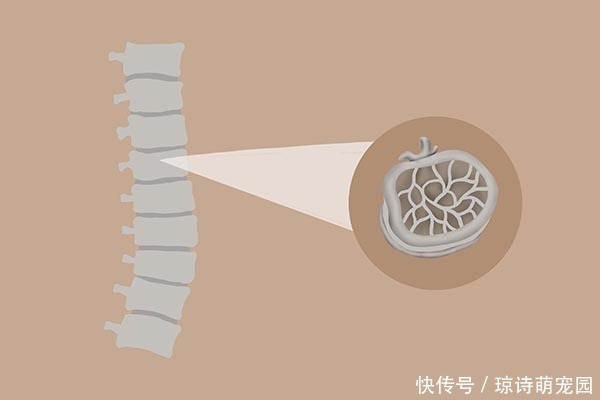 清单|50岁后，骨质渐渐流失，吃哪些食物能预防疏松？医生列出了清单