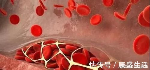 垃圾|劝告大家：1种豆是“吸毒王”，吸附血管垃圾，疏通血管，更长寿