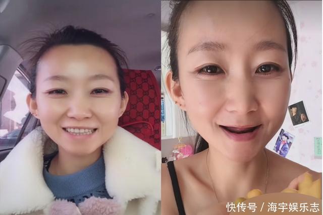 美女因病被迫拔光满嘴牙齿后自嘲：拿掉假牙，咱是最年轻的老太太