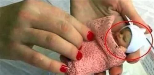 阿米莉亚|18年了,那个出生仅25厘米,曾打破世界纪录的女婴,如今已认不出