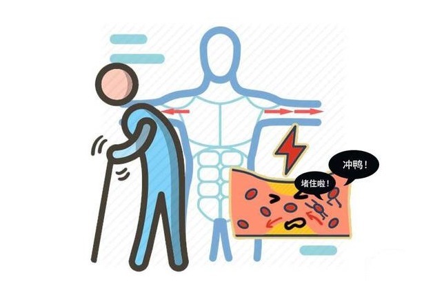 并发症|血糖高,放任不管?千万别不当回事,4个后果哪个也不好对付