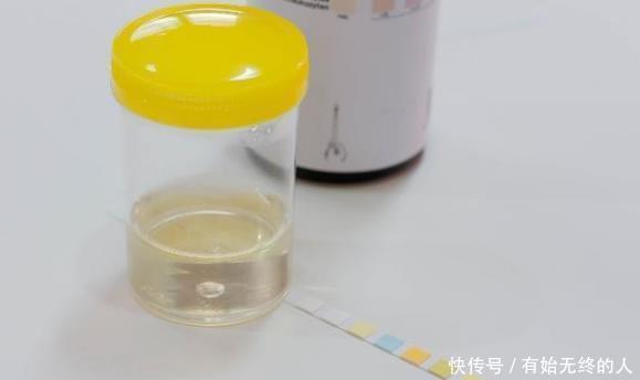 尿液很黃、還有異味,是上火嗎多半是在向你“稟告”幾件事