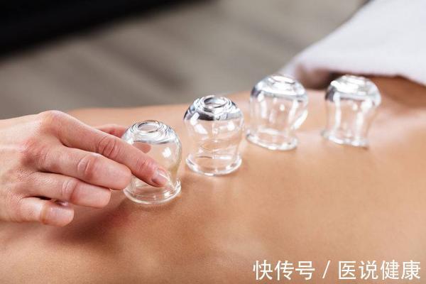 火罐|拔火罐时,要注意这4件事,否则反而会导致健康受损,需了解
