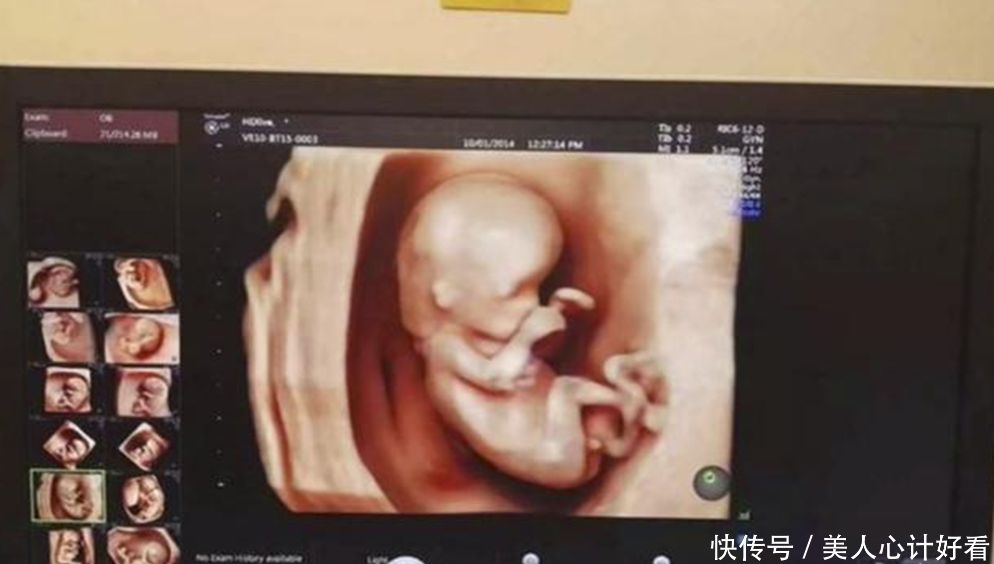 怀孕以后|孕期B超去几次?新手妈妈们别再问医生了,“孕期检查表”收好