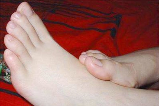 脚趾|想长寿先看脚,脚是长寿的“指明灯”,若无3现象,轻松活到100岁