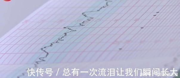 妈妈|妈妈辛苦怀胎十月，生产前婴儿出现异状，生产后医生23年没见过