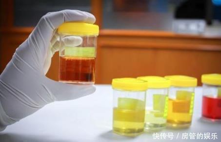 肾脏|“肾好”的男人才好若身体出现“3黑1臭”,多半是“肾”在求救