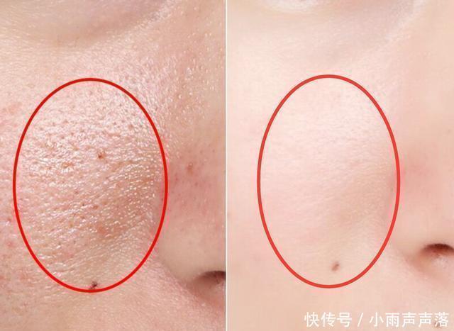 兰蔻圣罗兰等产品不合格被拒入境，业绩高手欧莱雅再陷“质检门”