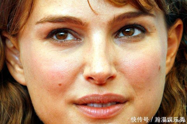 为变美,母女二人双双患癌,原来是这个东西害