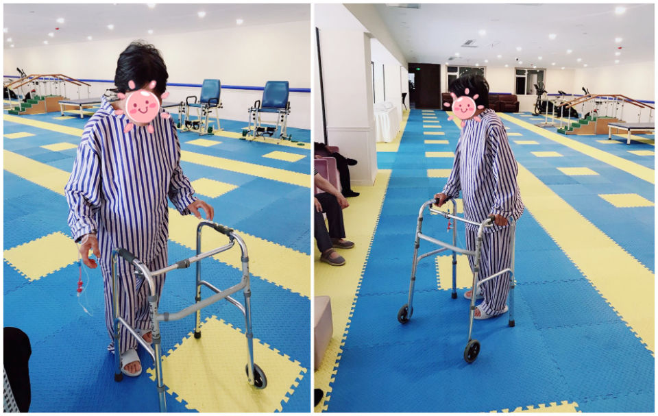 骨性关节炎|十年双膝骨性关节炎患者在济南南郊医院告别关节痛，迈向新生活