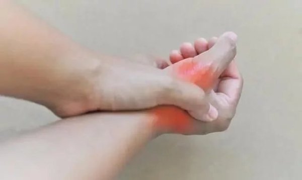 尿酸高的人,睡觉往往有5种表现,若都没有,说明身体还算健康