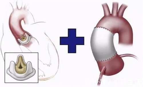 ccu|心衰十年求医未果,驱车千里慕名而来 7天后好转出院,值得思考