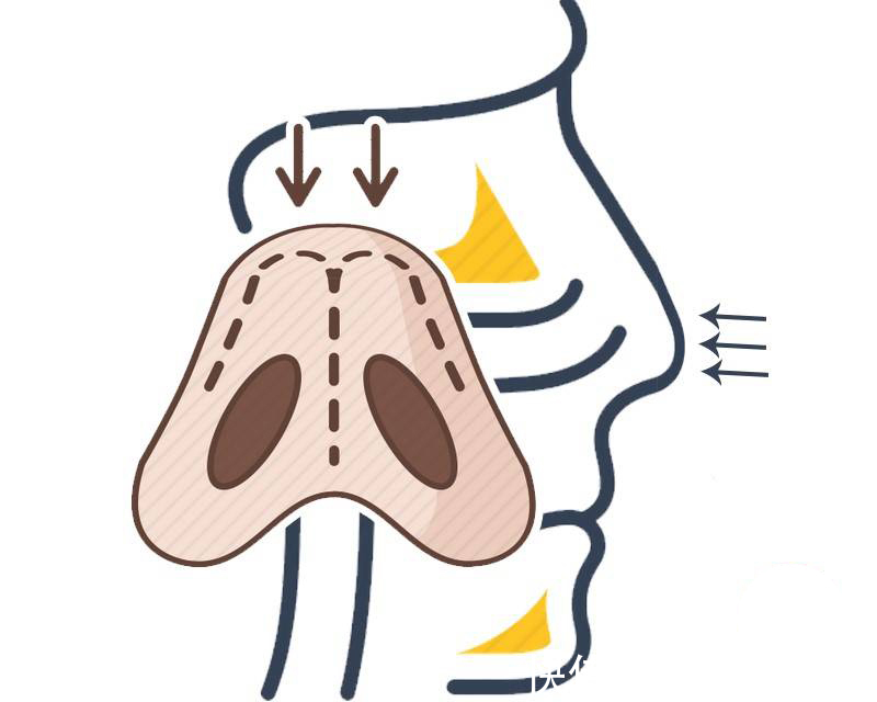 小林|男子一晚呼吸暂停176次?睡觉打鼾并非好事,背后或与这3件事有关