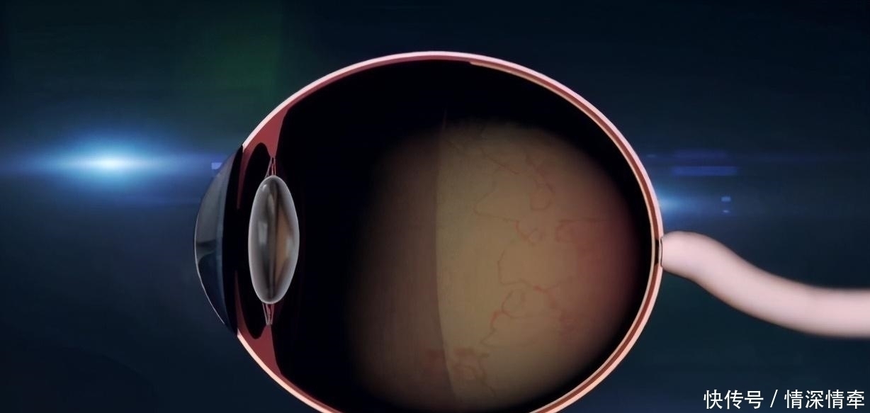 近视|美国最新研究发现:玩手机并不会让孩子近视,这件事才是“真凶”