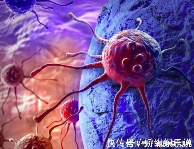 乳腺癌|乳腺癌是“惯”出来的?4个举止容易“招惹”乳癌,女性需注意