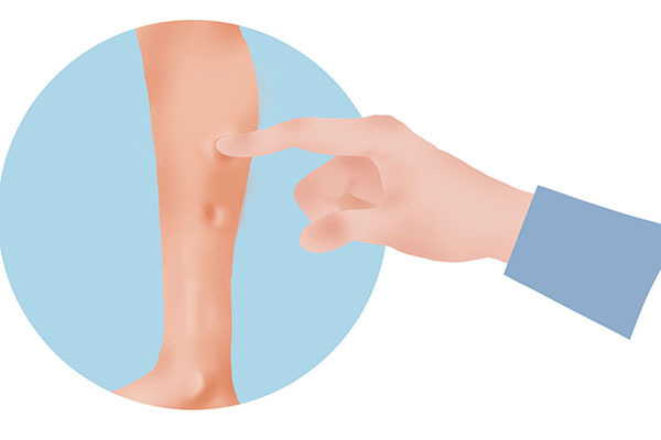 患者|一天中什么时间最适合吃降压药高血压患者,要牢记吃药原则