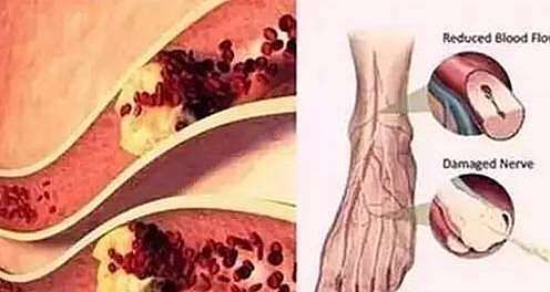 微循环|睡前足背拉一拉，通经活络，比按摩有效，方便还好学！